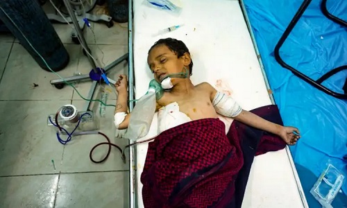 enfant_yemen_cancer-jpg100